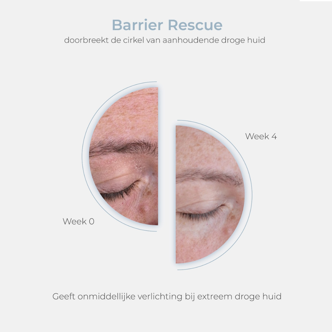 ESSE Barrier Rescue (80ml!)