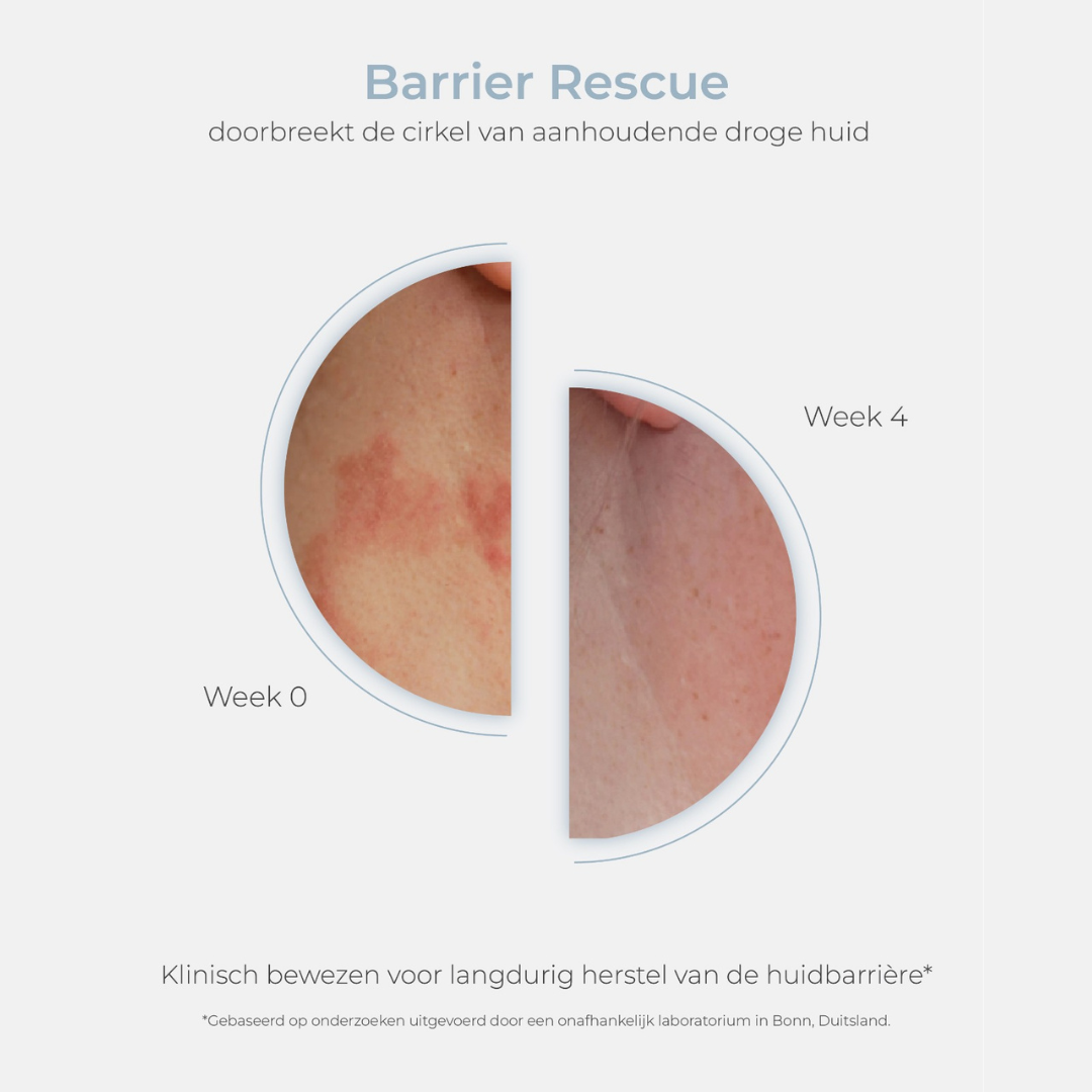 ESSE Barrier Rescue (80ml!)